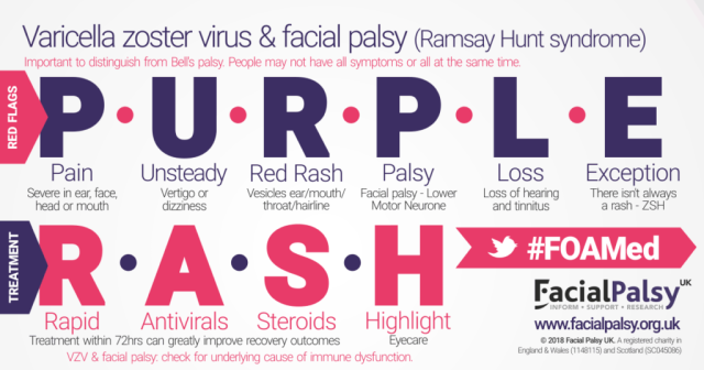 Ramsay Hunt syndrome Mnemonic