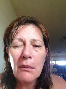 Elizabeth struggling to close one eye