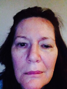 Elizabeth unsmiling showing the changes in her face as one side looks like it is frowning.