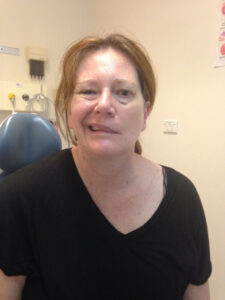 Elizabeth open mouth smiling with facial palsy