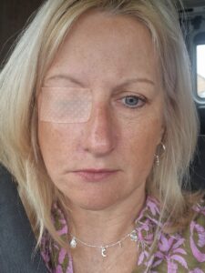 Female with one eye taped closed.